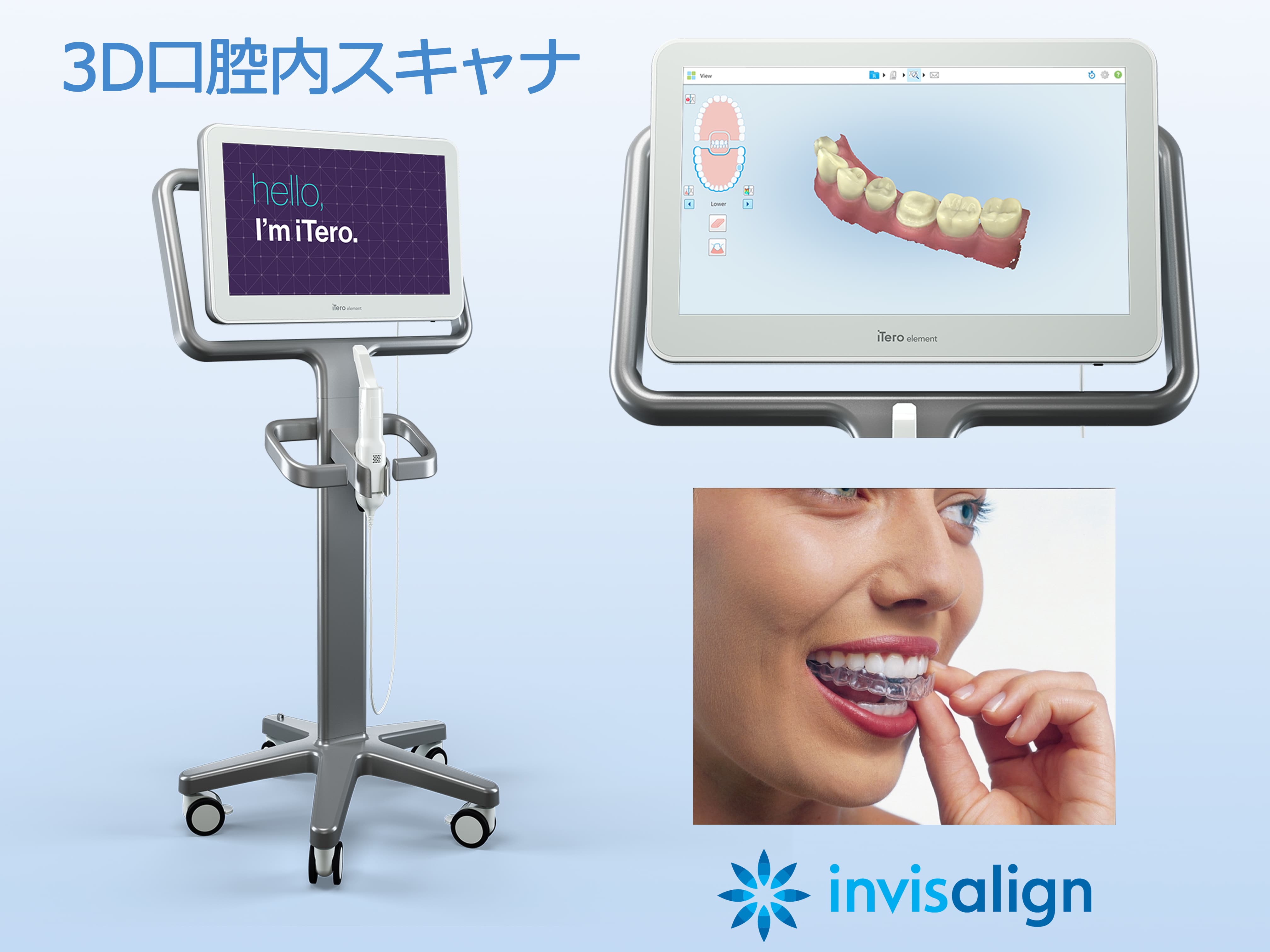 3D口腔内スキャナ