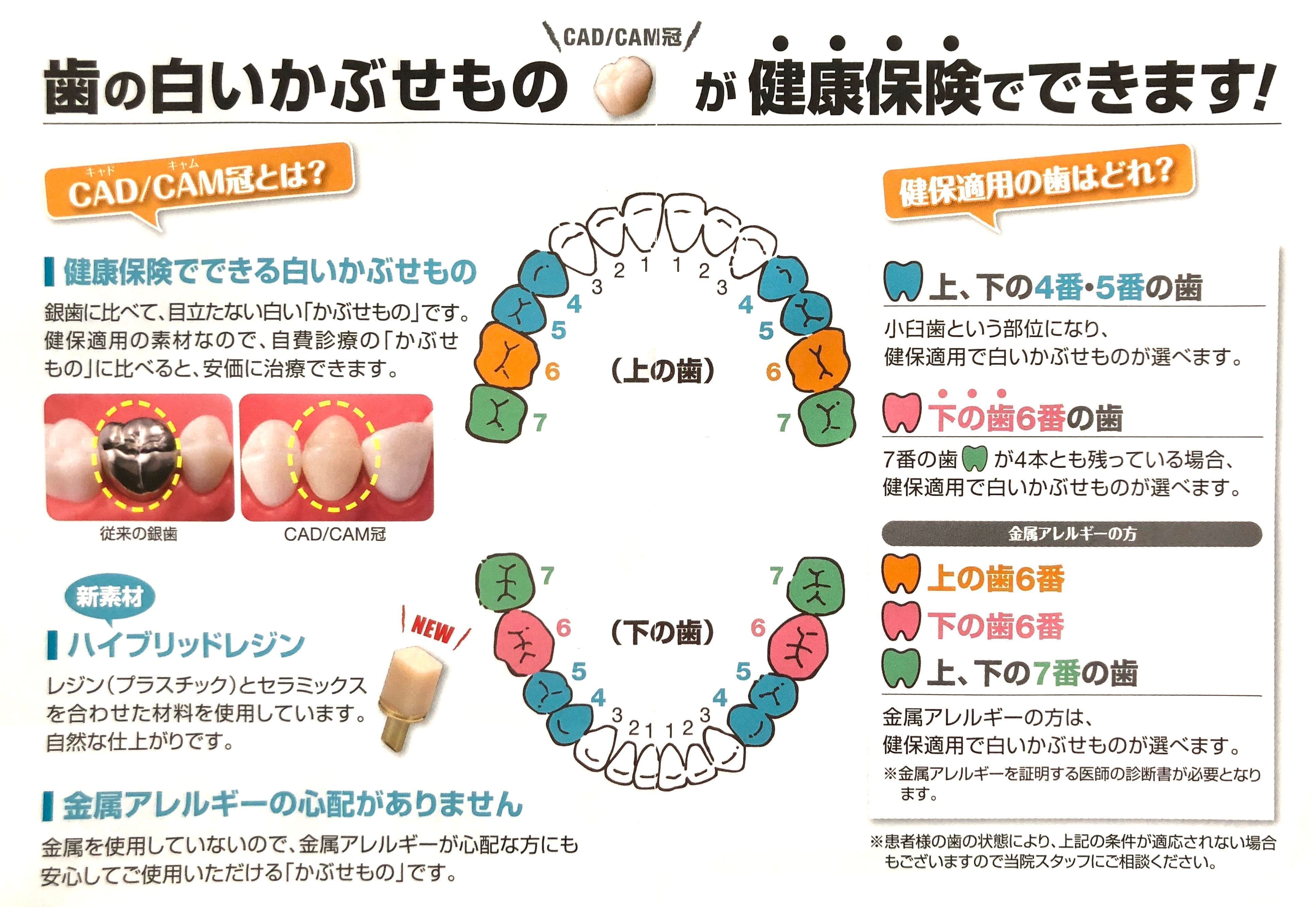 CAD/CAM冠