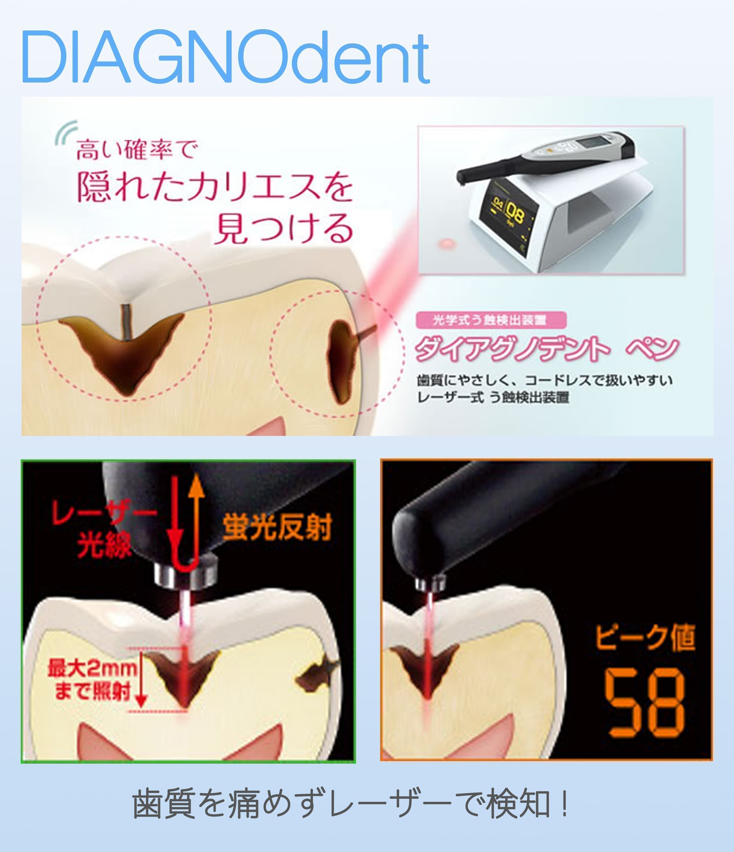 虫歯の早期発見