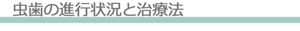 虫歯の進行状況と治療法