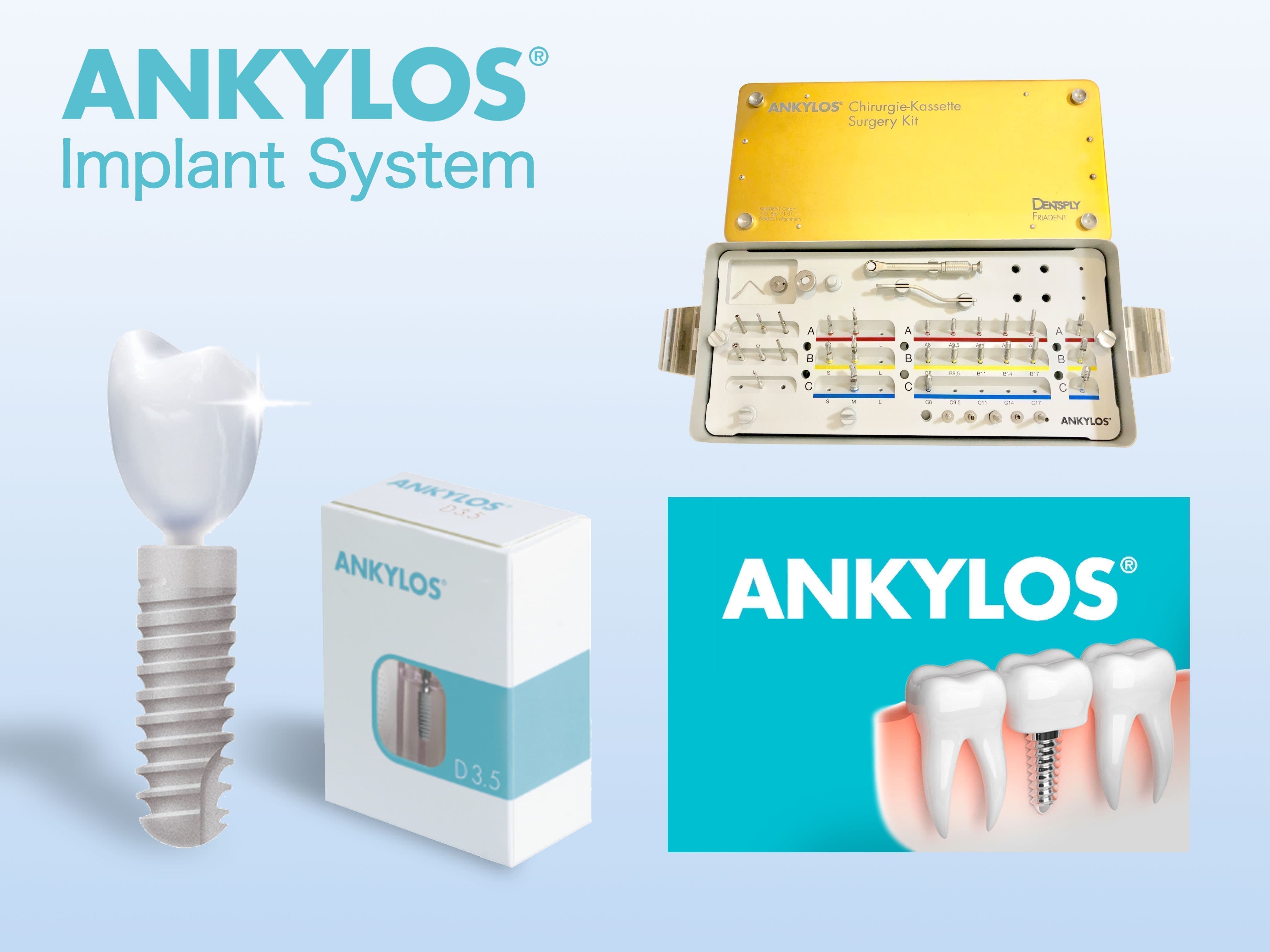 アンキロスインプラントシステム